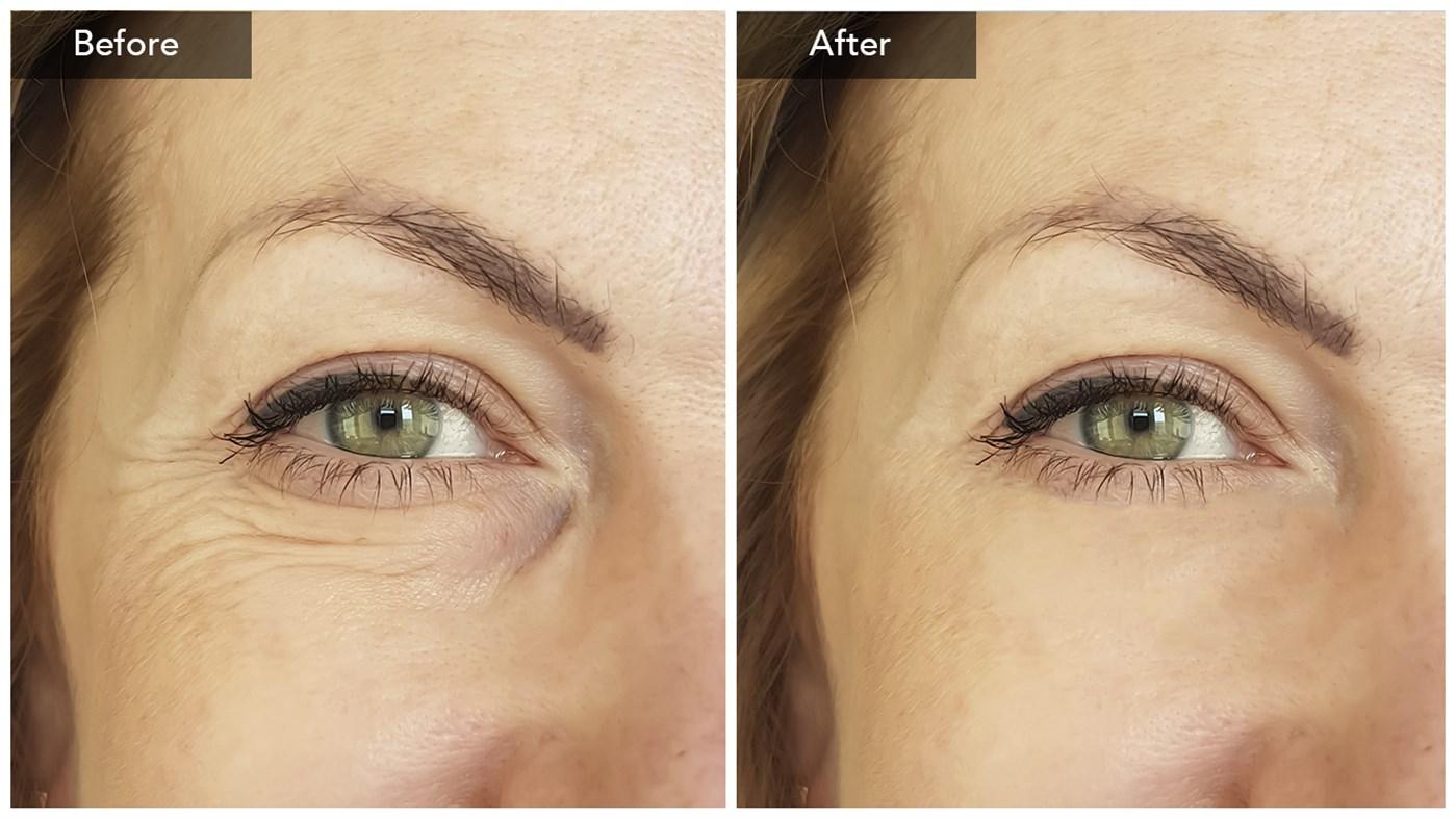 InPixio Photo Clip 7 Professional مفتاح (مدى الحياة / 5 اجهزة كمبيوتر مكتبي)